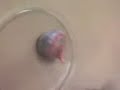 oog ontleden