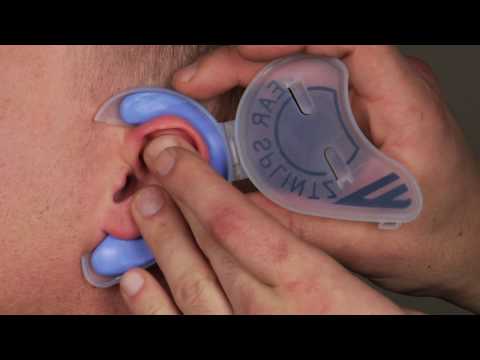 how to treat cauliflower ear