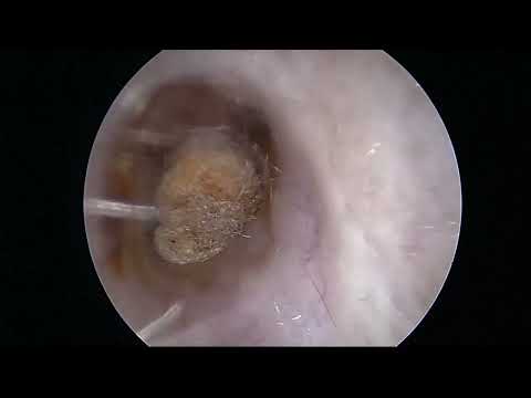 video-img