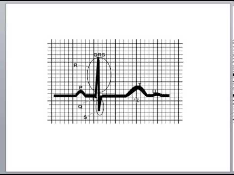 how to measure qrs wave