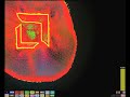The first public demonstration of OpenCL functionality was by AMD's FirePro / Firestream team at Siggraph Asia 2008. The particle  fluid simulation shows how OpenCL can extract high performance parallel computing out of GPUs, DSPs and multicore CPUs. Basically the idea is that you can write up your core computational code in OpenCL and suddenly you scale to whatever processors are available. Initially the demo only uses one core of a Dragon-based system (quad-core Phenom II). As the ...