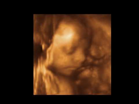 Baby Kinsley 28 weeks 3D 4D Ultrasound Scans – Charlotte 3D/4D Ultrasound