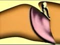 Travel Inside the Ear
