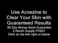 Acne Skin Care Products  Acne Skin Care