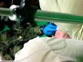 Catheter-into-the-Ju