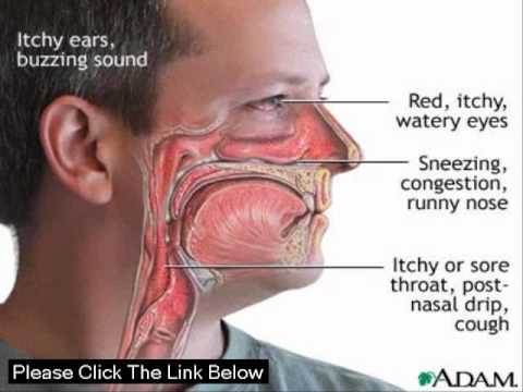 how to cure syphilis