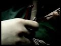 surgery appendectomy medicine jomar marcelo ligation