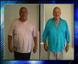 Sleeve Gastrectomy- Mercy Bariatrics Videos