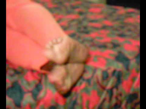toe spreading