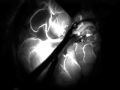 Fluorescent Identification Of The Middle Cranial Artery- Part 2 Fluorescent Identification Of The Middle Cranial Artery- Part 2