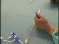 Nanto-s-technique