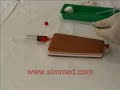 Venous Access with Syringe