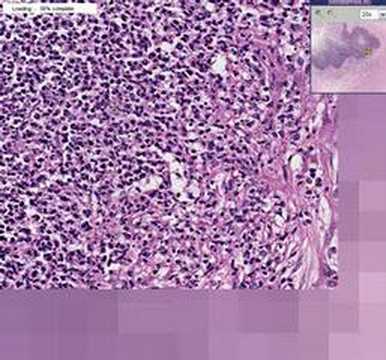 Histopathology Brain, cerebellum  ...