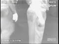 Fart Caught On Infrared Camera Fart Caught On Infrared Camera