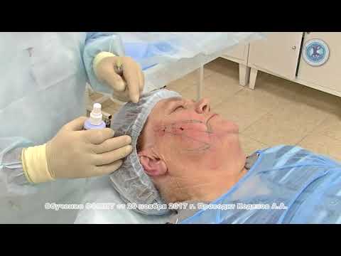 Комплексная коррекция щечно-скуловой области нити Spring Thread 20/11/2017 | ОСМНТ Комплексная коррекция щечно-скуловой области нити Spring Thread 20/11/2017 | ОСМНТ