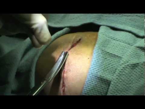 how to perform surgery