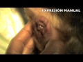 Impactación, saculitis y abcesos de sacos anales