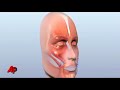 Chimp Attack Victim Gets Face Transplant