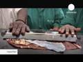 Mali's fight against malnutrition