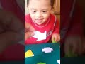 Down syndrome:&nbsp;S�ndrome de Down: Discriminaci�n de formas