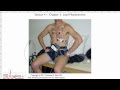 ECG Interpretation, ECG Electrode Misplacement, Part 4-3
