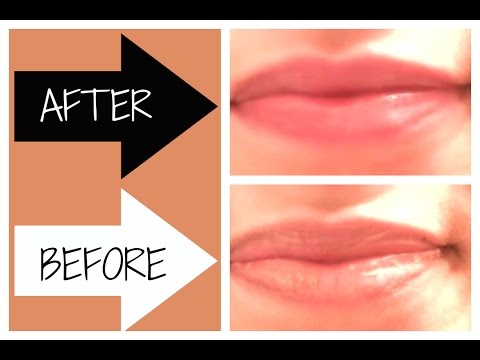 how to repair chapped lips