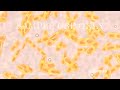 If you like this animation, LIKE us on Facebook: www.nucleusinc.com www.nucleusinc.com This medical animation outlines the various functions of the liver and describes the liver biopsy procedure, which involves the removal of a sample of tissue (biopsy). A liver biopsy is usually performed to identify abnormal conditions, such as hepatitis, jaundice, and cancer.
