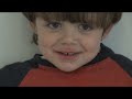 \"Should You See a Speech Pathologist?\" featuring Dr. Stewart (TongueTieMD)