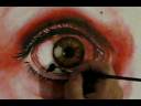 Speed painting of infected eye Acrylic by Daniel Chashoudian