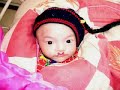LWB Cleft Nutrition Video LWB Cleft Nutrition Video