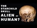Starchild Skull 2010 DNA Result