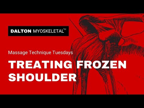 how to treat frozen shoulder