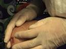 Knee Draining #2 : A must see.....
