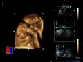 39 week 4d ultrasound clip