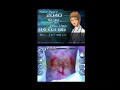 Trauma Center: Under the Knife 2 Gameplay