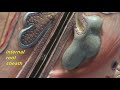 Composite Skin Model - Hair Follicle