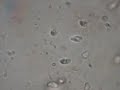 Flagellata(Costia) in discus fisch\