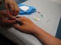 Right hand HITAG RFID implant injection Right hand HITAG RFID implant injection