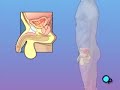 PreOp® Patient Education: CystoscopyMale Surgery