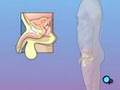 PreOp® Patient Education: CystoscopyMale Surgery