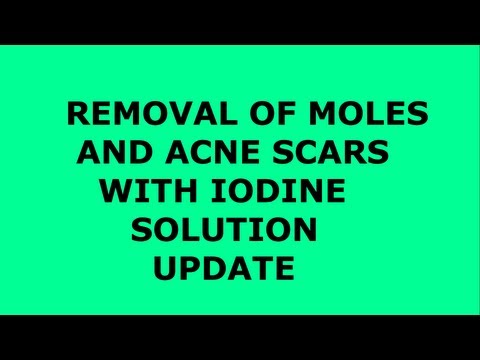 how to remove iodine from skin