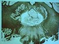 Pons (Level of deep cerebellar nuclei) Pons (Level of deep cerebellar nuclei)