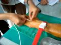 infus 1