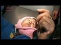 Palestinian medical sources say 21 of their staff have been killed during Israels military offensive in the Gaza Strip.Victims of one strike in Gaza City were forced to wait four hours for assistance after medics were forced to abandon their vehicles and walk 2km to reach them.Imran Khan reports.