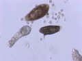 Schistosoma  mansoni mother sporocyst and eggs