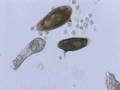 Schistosoma  mansoni mother sporocyst and eggs