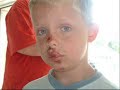 Ulykken Som Hendte Snorre