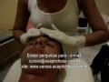 AULA 01 - VÍDEO AULA GRÁTIS DE LIMPEZA FACIAL COM RETIRADA DE CRAVOS