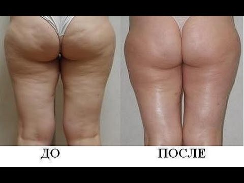 Потемнел ноготь на большом Полет на авиатренажере боевого самолета СУ 27 - подарочный