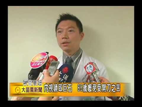 101.06.29 內視鏡取巨石 85歲嬤免受開刀之苦(肝膽腸胃科李傑哲)
